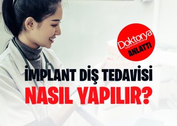 İmplant Diş Tedavisi Nasıl Yapılır?
