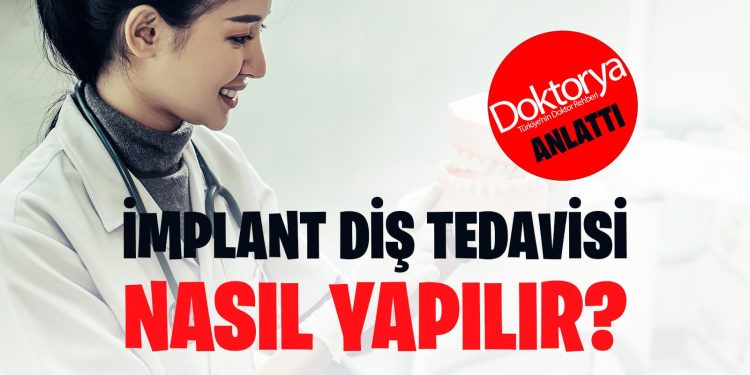 İmplant Diş Tedavisi Nasıl Yapılır?