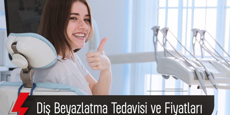 Diş Beyazlatma Tedavisi Ve Fiyatları